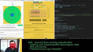 Biomedical Data Tools Live Development HMS  Harmful Brain Activity Classification [upl. by Childers]