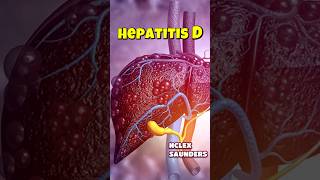 Hepatitis D  NCLEX Saunders 9th edition  saunders bscnursing medicalstudent neet aiims [upl. by Chanda]