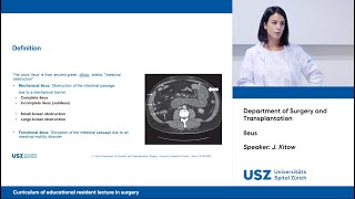 Ileus – Please participate in our 3minute survey below [upl. by Cock]