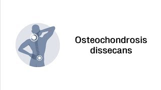 Osteochondrosis dissecans  Erkrankungen des Bewegungsapparates [upl. by Enilarac]