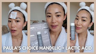 🆕️Paula’s Choice Mandelic  Lactic Acid AHA [upl. by Naugal176]