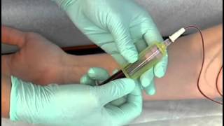 Sample Procedure  Venipuncture Butterfly Method [upl. by Anoiuq]