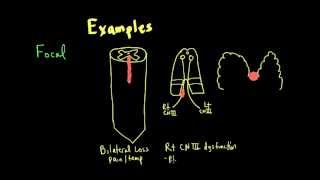 Schneid Guide to Neurological Lesion Localization [upl. by Wedurn]