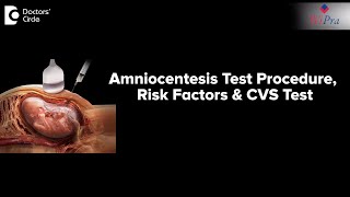 Amniocentesis Test Procedure and Risk Factors  CVS Test  Dr Sahana K P [upl. by Novonod]