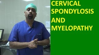 What is Cervical spondylosis Cervical Spinal cord compression and Myelopathy मानेचा संधिवात [upl. by Elocan]