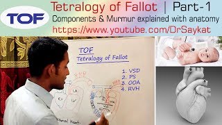 Tetralogy of Fallot TOF  Part 1  Components amp Murmur Explained  Dr Saykat [upl. by Elleinnad]