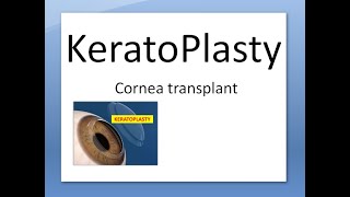 Ophthalmology 145 a Keratoplasty Cornea Transplant Eye donation Donor Surgery Indication Type Define [upl. by Carey]