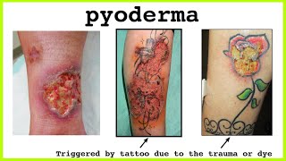 pyoderma [upl. by Natal35]