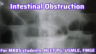 Intestinal obstruction For MBBS students Neet PG Usmle FMGE I Neet PG Usmle Preparation [upl. by Kendrah]