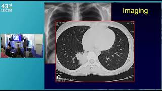 AIRWAY MANAGEMENT IN THE ICU ISICEM 2024 [upl. by Mazel]