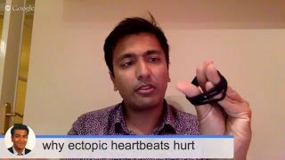 Why pvcs pacs and ectopic heartbeats hurt so bad [upl. by Verda224]