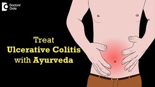 How to treat ulcerative colitis through Ayurveda  Dr Mini Nair [upl. by Archibald]