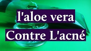 Comment Utiliser laloe Vera Pour Lacné [upl. by Chickie]