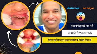 Implants with fix teeth within 7 Days implantwithfixteeth mumbaidental ulwe navimumbai [upl. by Ekeiram]