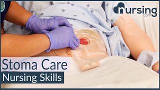 Stoma Care Changing a Colostomy Bag Nursing Skills [upl. by Acim451]