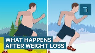 What Losing Weight Does To Your Body And Brain  The Human Body [upl. by Notlrak979]