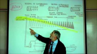 CARDIAC PHYSIOLOGY PART 4 by Professor Finkwmv [upl. by Trudie]