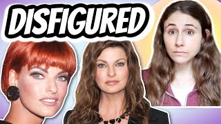 Linda Evangelista BRUTALLY DISFIGURED from COOLSCULPTING  Dermatologist Responds  Dr Dray [upl. by Joyan379]