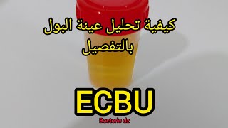 ECBU طريقة تحليل عينة البول بالتفصيل [upl. by Buchalter809]