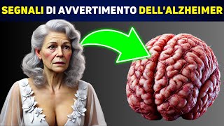 SCIENTIFICO Queste 5 Abitudini Sono Legate allAlzheimer [upl. by Scheer424]