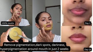 2 home remedies to remove dark spotsdark black patches pigmentation around mouth  100 results [upl. by Ahsienal545]