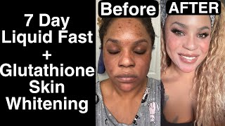 Permanent Skin Whitening  7 day Liquid fast here’s what happened [upl. by Nertie]