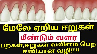 ஈறுகள் மேலே ஏறி அசிங்கமாக உள்ளதா Receding gums home remedy [upl. by Attenyw]