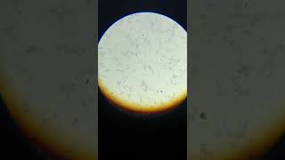 Widal test positive  widal T H positive 180 agglutination microscopic view  widaltest widal [upl. by Yaja]