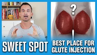 Best Place For Glute Injection  The Sweet Spot [upl. by Lawton]