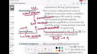 Ependymoma neurology 132  First Aid USMLE Step 1 in UrduHindi [upl. by Eldrid874]