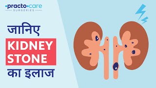 Kidney Stone Treatment in Hindi  गुर्दे के पथरी क्या है इलाज [upl. by Assiar603]