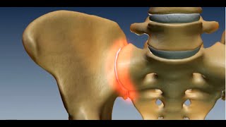 Where is the Sacroiliac Joint Anatomy of the Sacroiliac Joint [upl. by Anastatius]