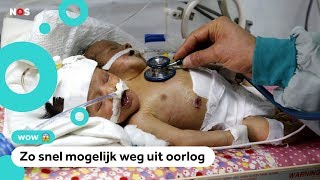 Hulp voor Siamese tweeling in oorlogsgebied [upl. by Arty]