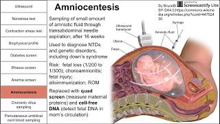 Prenatal screening fetal testing and other tests during pregnancy [upl. by Aratnahs]