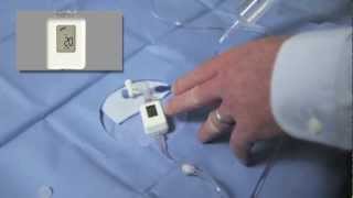 Compass Thoracentesis Tutorial [upl. by Pachton]