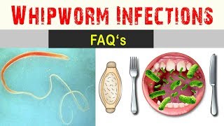 Whipworm infections  Frequently Asked Questions And Answers [upl. by Eelrefinnej]