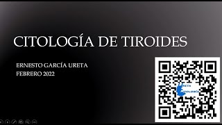 Citología de tiroides [upl. by Drugi]