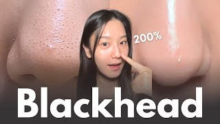 How to really remove blackheads at home in 7 days No matter your skin type [upl. by Salomo]