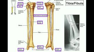 Anatomy  Specific Parts of the Tibia amp Fibula  Left vs Right [upl. by Hersh]