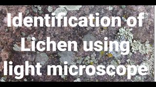 Identification of Lichen using Light microscope [upl. by Rimola]