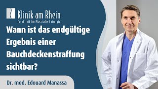 Wann ist das endgültige Ergebnis einer Bauchdeckenstraffung sichtbar  Klinik am Rhein [upl. by Anan]