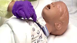 Tracheostomy Care Tutorial [upl. by Ecneralc]