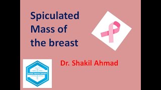 Spiculated Breast Mass with axilalry lymph nodes breastcancer [upl. by Haya]