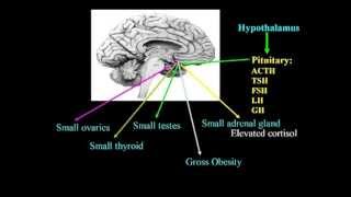 Excitotoxins Neurotoxins amp Human Neurological Disease Lecture  Dr Russell Blaylock [upl. by Erl]