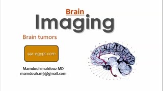 Imaging of supratentorial Brain tumors DRE Prof Mamdouh Mahfouz [upl. by Sew]