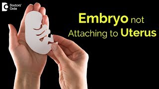 Why embryos dont stick in uterus How is it treated  Dr Rashmi Yogish  Doctors Circle [upl. by Gaige786]