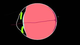 Common disorders of the eye and NCLEX style practice questions [upl. by Inirt]