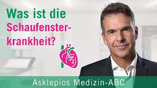 Was ist die Schaufensterkrankheit  Asklepios [upl. by Elyn713]