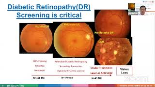 WEBINAR DIABETIC RETINOPHATY today from screening to management [upl. by Sissie]