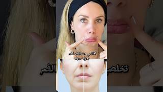 بخطوة سهلة تخلصي من تهدل الفمfaceyoga facemassage yoga مساجللوجه مساجعلاجي massagetherapy [upl. by Sinnoda531]